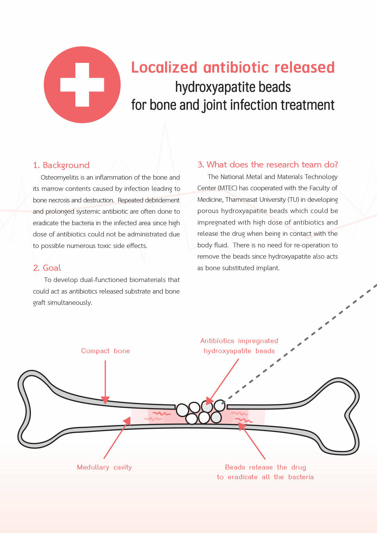 Localized Antibiotic Released Hydroxyapatite Beads For Bone And Joint Infection Treatment • MTEC